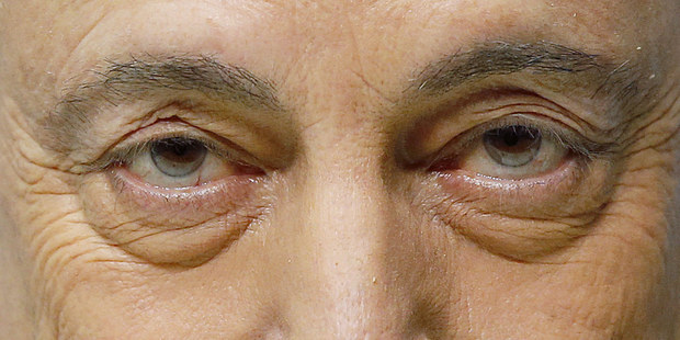 Urobi� to, alebo dr�a� hubu